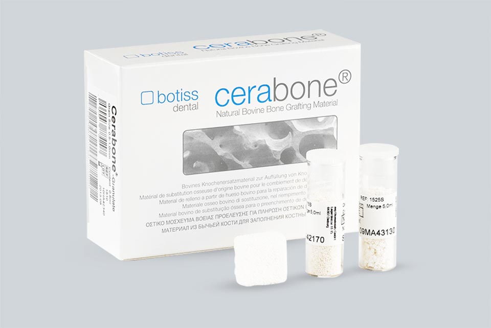 瑞士品牌 Straumann 德國製造 botiss cerabone 天然再生骨粉